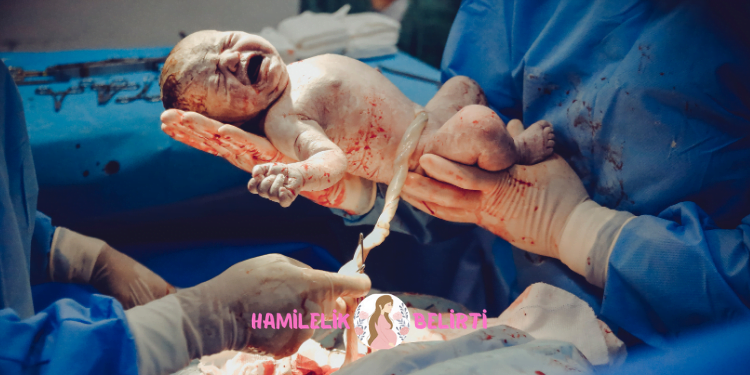 normal dogum ve sezaryen dogum - Doğum çantasında olması gerekenler ve hastane çantasında olması gerekenler doğum yapacak kişinin ihtiyaçları ve doğacak bebeğin sağlığı dikkate alınmalıdır.