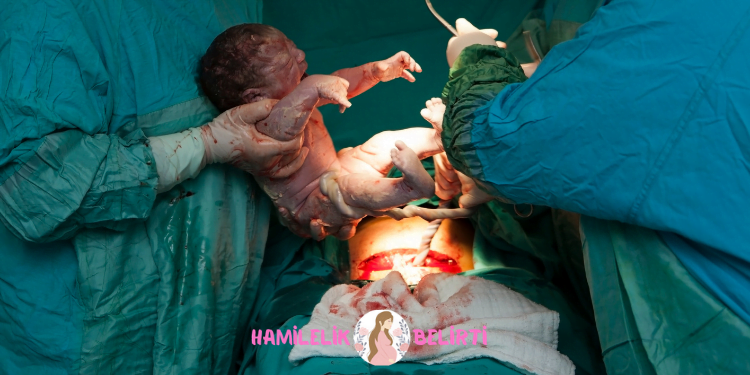 sezaryen doğum karnınızda bir kesim işlemi yapılarak bebeğin çıkarıldığı bir ameliyattır. Planlı sezaryen ve acil sezaryen durumları da mevcuttur.