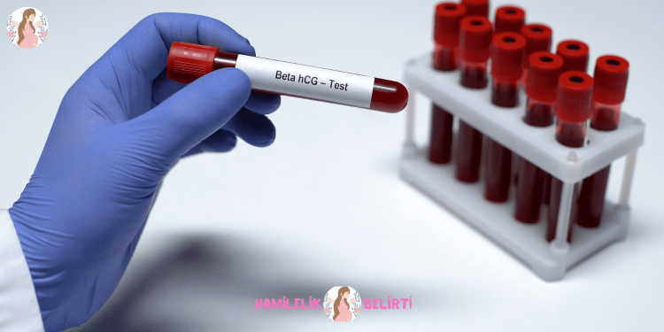 beta hcg 0.100 ne demek e1649605279280 - Hamilelik testi için size hamilelik kan testi, idrar testleri ve evde yapılan gebelik testi alternatif olarak sunabiliriz. Aralarındaki farklar ve daha fazlası.