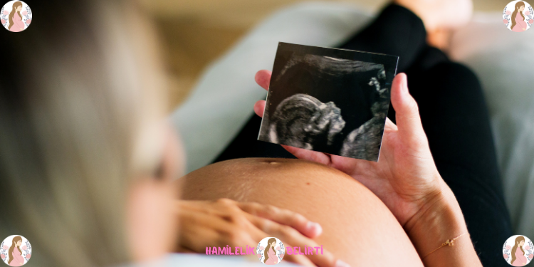 Polikistik Over Olup Tedavisiz Hamile Kalanlar 1 - Polikistik Over Olup Tedavisiz Hamile Kalanlar (PKOS) olarak da bilinen polikistik over, kadınların üreme çağındaki en yaygın hormonal bozukluklarından biridir. PKOS olan kadınların yaklaşık %70'i hamile kalmada zorluk yaşar ve daha yüksek bir düşük riski taşırlar. Bu nedenle, polikistik over sendromu olan kadınlar hamilelik sürecinde belirli zorluklarla karşılaşabilirler. Ancak, doğru tedavi ve takip ile hamile kalma şansları artırılabilir.